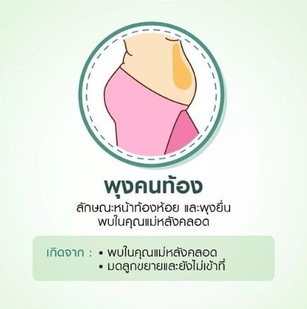 พุง ลักษณะ ต่างๆ-พุงคนท้อง