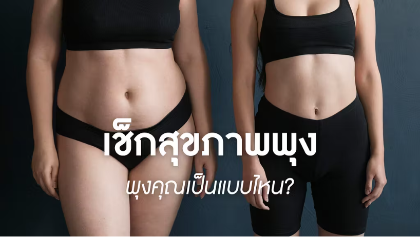 ลักษณะ อ้วน ลงพุง-แบ่งออกเป็นกี่แบบ